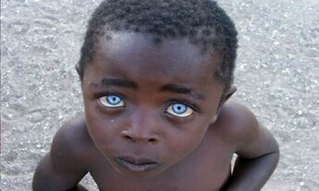 کمیاب‌ترین رنگ چشم در میان انسان‌ها کدام است؟