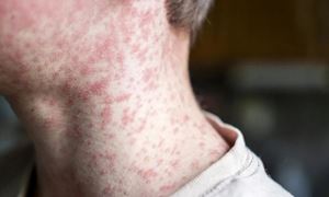 media.news.imagealternatetextformat.details