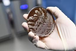 باکتری‌های مقاوم به دارو عامل مرگ میلیون‌ها نفر تا سال 20150