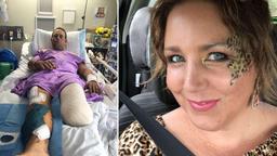 مدت انتظار طولانی بیمارستان در استرالیا برای جراحی کشاورز آسیب دیده