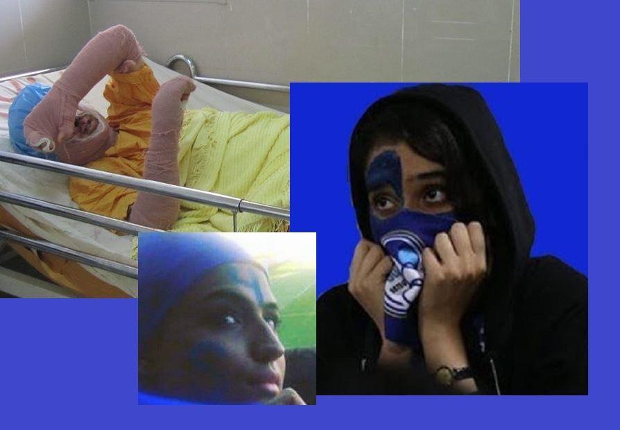 سحر خدایاری (دختر آبی) یک هفته پس از خودسوزی اعتراضی درگذشت