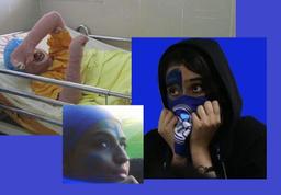 سحر خدایاری (دختر آبی) یک هفته پس از خودسوزی اعتراضی درگذشت