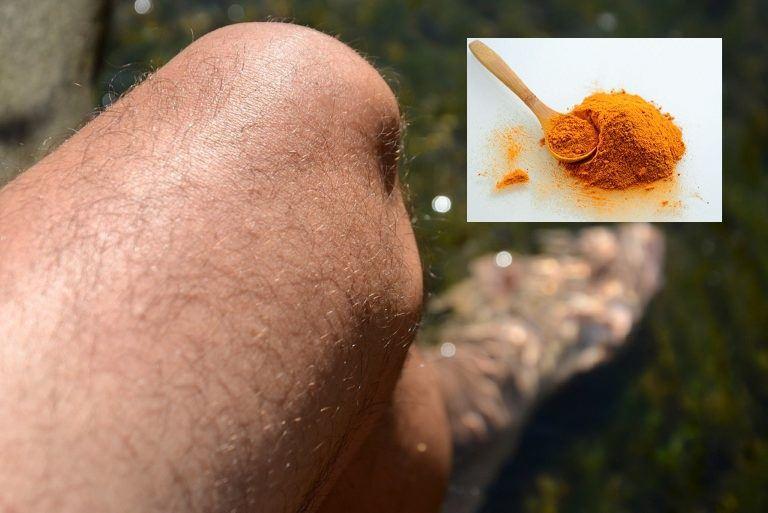 استفاده از زردچوبه برای بهبودی درد آرتروز مفصل زانو 