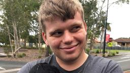 فرد مبتلا به اوتیسم در طول انجام عمل جراحی بدلیل اثر نکردن داروی بیهوشی، همچنان هوشیار بود