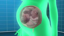 اسرائیل استفاده از رحم اجاره‌ای برای همجنسگرایان را تصویب کرد