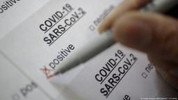 ادعای ترکیه‌ای‌ها در مورد ساخت کیت تشخیص کرونا در 10 ثانیه