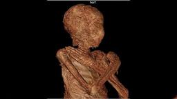 راز سالم ماندن جنین زن مومیایی 2 هزار ساله