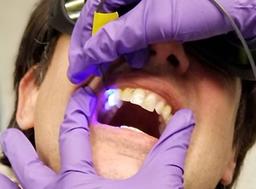 شناسایی پوسیدگی دندان با نور ال ای دی