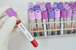 گزارش اولین نمونه ابتلای انسان به آنفولانزای پرندگان در چین