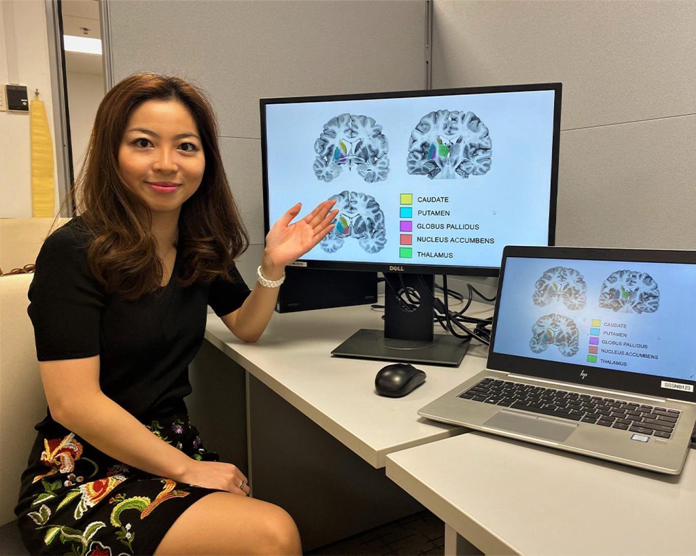 دمای مغز زنان بیش از مردان است