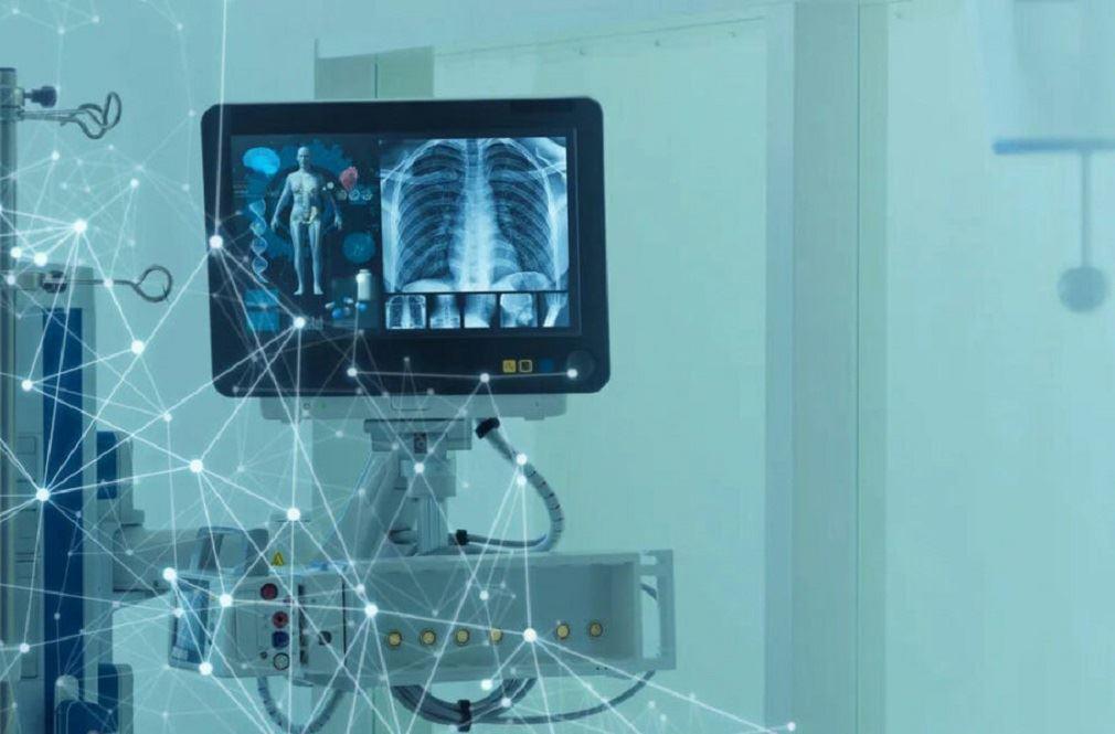 تشخیص بیماری‌های ریوی با هوش مصنوعی و دقت 98 درصدی