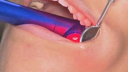 وداع با آمپول دندانپزشکی با ورود تکنولوژی جدید محققان استرالیایی