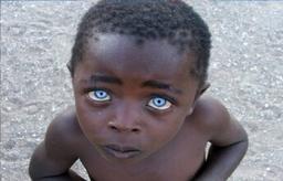 کمیاب‌ترین رنگ چشم در میان انسان‌ها کدام است؟