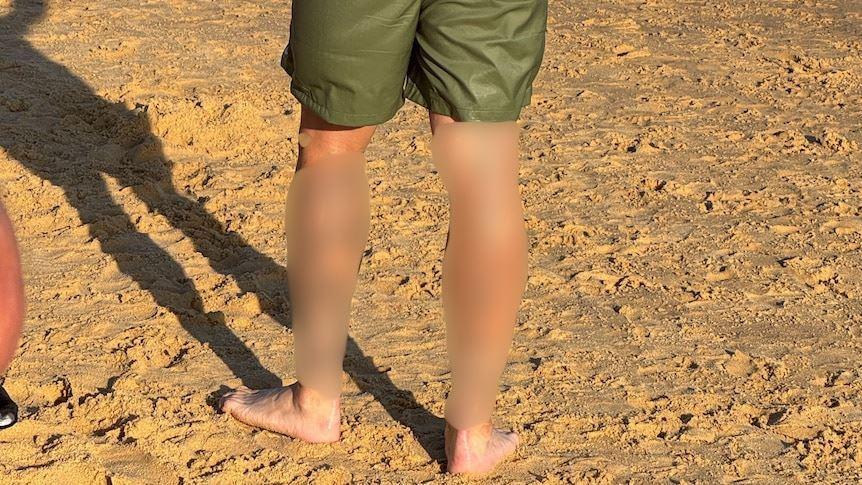 بازداشت مردی در نیوکاسل به دلیل خالکوبی نمادهای نفرت‌پراکنی