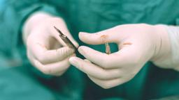 جهش بی‌سابقه آمار وازکتومی در میان مردان جوان استرالیایی