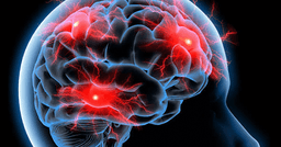 افراد عاطفی ساختار مغزی متفاوتی دارند