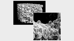 ابداع شیوه نوین درمان شکستگی شدید استخوان توسط محققین استرالیایی