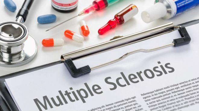 روشی تازه اما خطرناک در درمان ام‌اس "پیوند سلول‌های بنیادی بعد از سرکوب سیستم ایمنی"