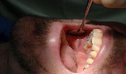 موضوع: زخمها و بیماریهای دهان/ همراه با دکترمهرداد ابولقاسمی