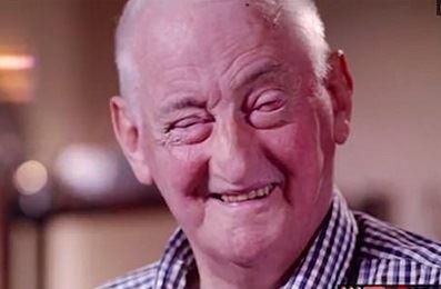 بازگشت بینایی یک مرد 72 ساله با روش جدید پزشکان استرالیا