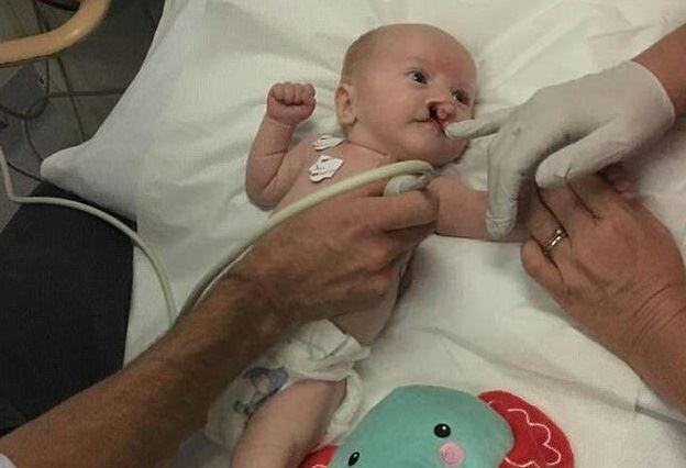 حفره‌ای دردناک در دهان نوزاد ۳ ماهه استرالیایی