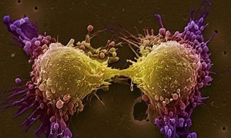 محققان استرالیا : بیماران سرطانی را می توان با القای پیام خودکشی به سلول های سرطانی نجات داد