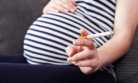 محققان استرالیا...سیگار کشیدن در دوران بارداری ، خطر فلج مغزی در نوزادان را افزایش می دهد