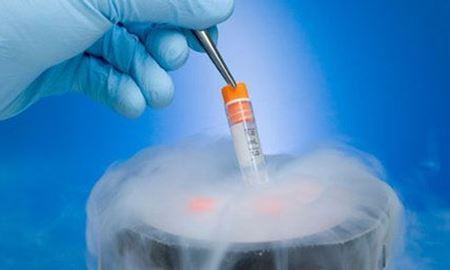 ارائه روشی برای حفظ کیفیت اسپرم پس از انجمادتوسط محققان ایران و استرالیا