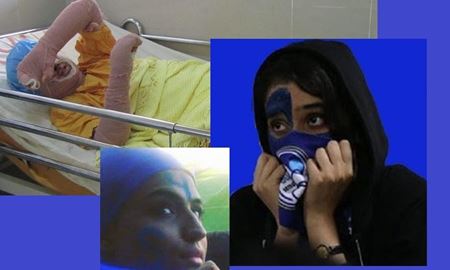 سحر خدایاری (دختر آبی) یک هفته پس از خودسوزی اعتراضی درگذشت