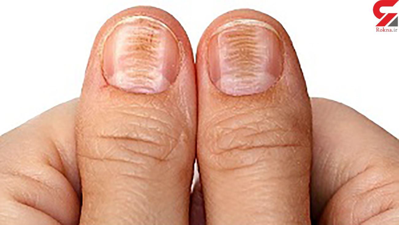 media.news.imagealternatetextformat.details