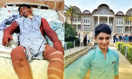 فوت نوجوان فداکار ایرانی بر اثر سوختگی شدید