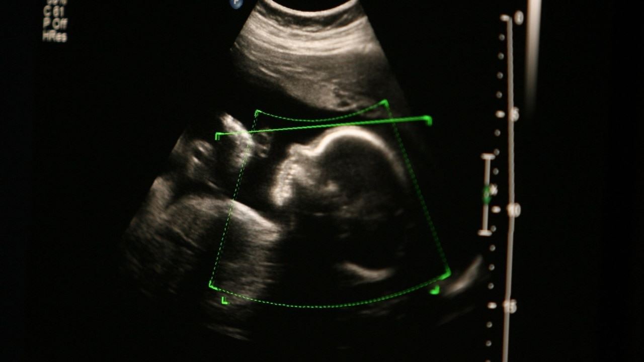 media.news.imagealternatetextformat.details