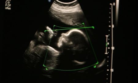 سقط جنین در استرالیای غربی دیگر جرم محسوب نمی‌شود