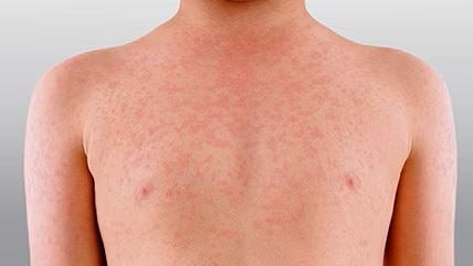 media.news.imagealternatetextformat.details